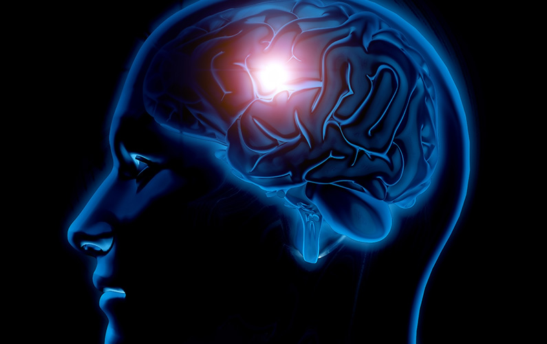 3d-male-medical-figure-with-brain-highlighted