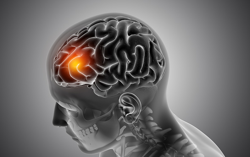 male-medical-figure-with-front-of-the-brain-highlighted